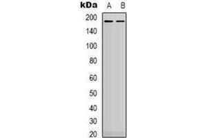 Western blot analysis of HER2 expression in MDA (A), SKOV3 (B) whole cell lysates. (ErbB2/Her2 antibody  (C-Term))