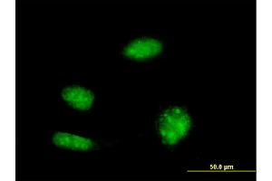 Immunofluorescence of monoclonal antibody to KHSRP on HeLa cell. (KHSRP antibody  (AA 151-239))