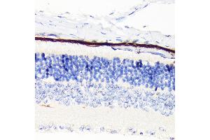 Immunohistochemistry of paraffin-embedded mouse retina using RPE65 Rabbit mAb (ABIN7269933) at dilution of 1:100 (40x lens). (RPE65 antibody)