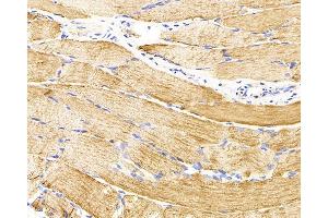 Immunohistochemistry analysis of parafffin-embedded rat skeletal muscle using Desmin Monoclonal Antibody at dilution of 1:300. (Desmin antibody)