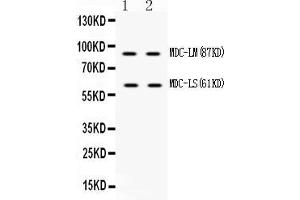 Western blot analysis of ADAM28 using anti-ADAM28 antibody . (ADAM28 antibody  (N-Term))
