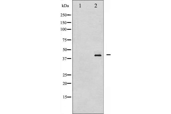 HDAC8 Antikörper  (pSer39)