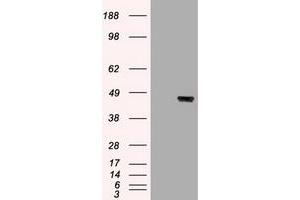 Image no. 1 for anti-Keratin 19 (KRT19) (AA 240-390) antibody (ABIN1491257) (Cytokeratin 19 antibody  (AA 240-390))