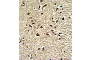 Formalin-fixed and paraffin-embedded human brain tissue reacted with PAX4 Antibody , which was peroxidase-conjugated to the secondary antibody, followed by DAB staining.