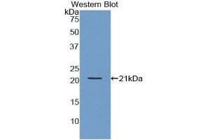 Western Blotting (WB) image for anti-Actin Related Protein 2/3 Complex, Subunit 4, 20kDa (ARPC4) (AA 3-165) antibody (ABIN3202611) (ARPC4 antibody  (AA 3-165))
