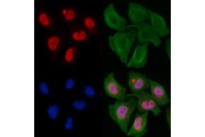ABIN6256428 and ABIN6267317 staining Hela cells by IF/ICC. (Retinoblastoma Protein (Rb) antibody  (pSer807))