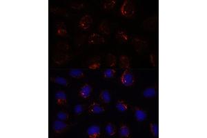 Immunofluorescence analysis of U-2 OS cells using BZW2 antibody (ABIN7265831) at dilution of 1:100. (BZW2 antibody  (AA 190-300))