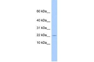 C10ORF132 antibody used at 1 ug/ml to detect target protein. (GOLGA7B antibody  (N-Term))