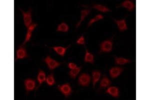 ABIN6275211 staining Hela by IF/ICC. (LDLRAD1 antibody  (Internal Region))