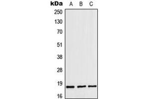 Western blot analysis of ZNHIT1 expression in MOLT4 (A), mouse heart (B), rat heart (C) whole cell lysates. (ZNHIT1 antibody  (Center))