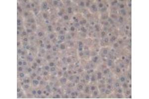 IHC-P analysis of Rat Liver Tissue, with DAB staining.
