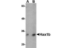Western Blotting (WB) image for anti-Hax1b (N-Term) antibody (ABIN1031401) (Hax1b (N-Term) antibody)