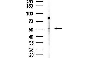 anti-Mixed Lineage Kinase Domain-Like (MLKL) (Internal Region) antibody