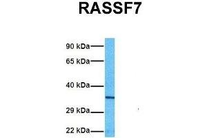 Host:  Rabbit  Target Name:  RASSF7  Sample Tissue:  Human A549  Antibody Dilution:  1. (RASSF7 antibody  (Middle Region))