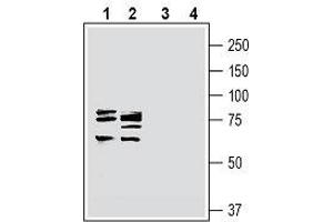 Western blot analysis of rat brain lysate (lanes 1 and 3) and mouse brain lysate (lanes 2 and 4): - 1, 2. (Cortactin antibody  (Intracellular))