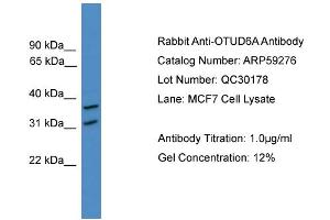 WB Suggested Anti-OTUD6A  Antibody Titration: 0. (OTUD6A antibody  (N-Term))