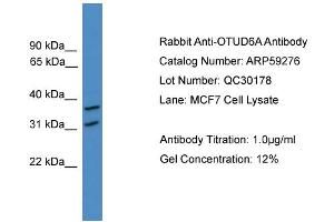 OTUD6A antibody  (N-Term)