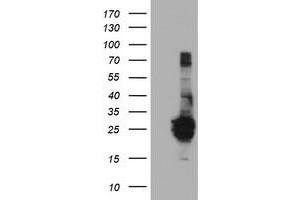 HEK293T cells were transfected with the pCMV6-ENTRY control (Left lane) or pCMV6-ENTRY FGF21 (Right lane) cDNA for 48 hrs and lysed. (FGF21 antibody  (AA 29-209))