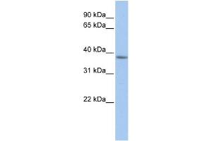 WB Suggested Anti-C2orf33 Antibody Titration:  0. (MFF antibody  (C-Term))