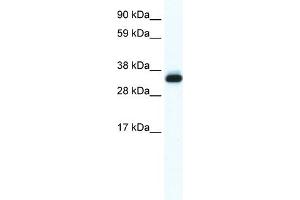 WB Suggested Anti-ANXA5 Antibody Titration:  0.