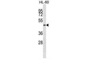 KRT28 Antibody (C-term) western blot analysis in HL-60 cell line lysates (35µg/lane). (Cytokeratin 28 antibody  (C-Term))