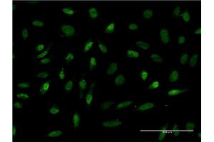 Immunofluorescence of monoclonal antibody to RBMS2 on HeLa cell. (RBMS2 antibody  (AA 308-407))