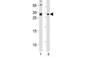 Western blot analysis of lysate from (1) mouse brain and (2) mouse skeletal muscle tissue lysate using Olig3 antibody at 1:1000. (OLIG3 antibody  (N-Term))