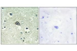 Immunohistochemical analysis of paraffin-embedded human brain tissue using NMDAR1 (Phospho-Ser890) antibody (left)or the same antibody preincubated with blocking peptide (right). (GRIN1/NMDAR1 antibody  (pSer890))