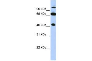 Western Blotting (WB) image for anti-Tripartite Motif Containing 9 (TRIM9) antibody (ABIN2458078)