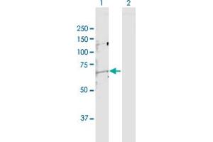 Western Blot analysis of MMP14 expression in transfected 293T cell line by MMP14 MaxPab polyclonal antibody. (MMP14 antibody  (AA 1-582))