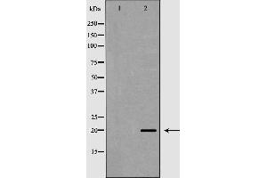 Western blot analysis of Hepg2 whole cell lysates, using TAF9 Antibody. (TAF9 antibody  (Internal Region))
