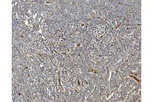 IHC analysis of EIF3C using anti-EIF3C antibody (ABIN7602528). (EIF3C antibody  (AA 81-637))