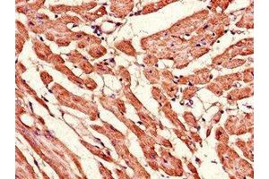 Immunohistochemistry of paraffin-embedded human heart tissue using ABIN7159968 at dilution of 1:100 (MFN2 antibody  (AA 61-158))