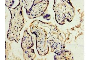 Immunohistochemistry of paraffin-embedded human placenta tissue using ABIN7150057 at dilution of 1:100 (ADAM33 antibody  (AA 140-420))