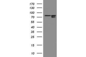 Image no. 5 for anti-Spastic Paraplegia 7 (SPG7) (AA 300-573) antibody (ABIN1491371) (SPG7 antibody  (AA 300-573))