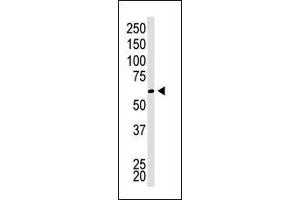 The anti-CBX4 C-term Pab (ABIN389087 and ABIN2839283) is used in Western blot to detect CBX4 in Jurkat cell lysate. (CBX4 antibody  (C-Term))