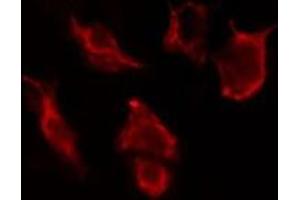 ABIN6277108 staining HuvEc cells by IF/ICC. (CD90 antibody  (Internal Region))