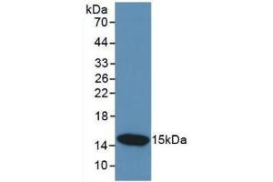 Detection of Recombinant CST3, Human using Monoclonal Antibody to Cystatin C (Cys-C) (CST3 antibody  (AA 27-146))