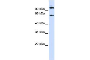 WB Suggested Anti-RUNX1T1 Antibody Titration: 0. (RUNX1T1 antibody  (Middle Region))
