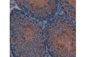 Used in DAB staining on fromalin fixed paraffin- embedded Kidney tissue (CYP11A1 antibody  (AA 329-526))