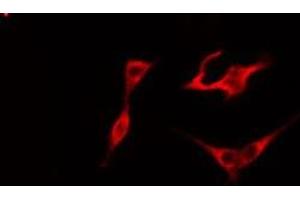 ABIN6275755 staining COLO205 cells by IF/ICC. (STARD10 antibody  (Internal Region))
