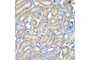 Immunohistochemistry of paraffin-embedded rat kidney using PDCD6 antibody. (PDCD6 antibody  (AA 1-191))