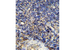 Immunohistochemistry (IHC) image for anti-Protein tyrosine Phosphatase, Receptor Type, C (PTPRC) (AA 1245-1275), (C-Term) antibody (ABIN5533903)