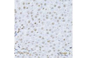 Immunohistochemistry (Paraffin-embedded Sections) (IHC (p)) image for anti-Mitogen-Activated Protein Kinase 3 (MAPK3) (AA 1-100) antibody (ABIN3020725)