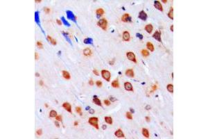Immunohistochemical analysis of CHK1 staining in human brain formalin fixed paraffin embedded tissue section. (CHEK1 antibody  (Center))