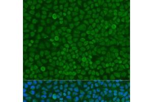 Immunofluorescence analysis of U2OS cells using YWHAZ Polyclonal Antibody at dilution of 1:100. (14-3-3 zeta antibody)