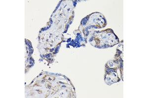 Immunohistochemistry of paraffin-embedded human placenta using ErbB4/HER4 Rabbit pAb (ABIN6131263, ABIN6140257, ABIN6140260 and ABIN6221732) at dilution of 1:100 (40x lens). (ERBB4 antibody  (AA 26-160))