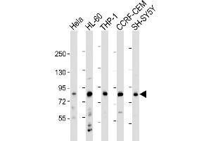 All lanes : Anti-LRCH4 Antibody (Center) at 1:2000 dilution Lane 1: Hela whole cell lysate Lane 2: HL-60 whole cell lysate Lane 3: THP-1 whole cell lysate Lane 4: CCRF-CEM whole cell lysate Lane 5: SH-SY5Y whole cell lysate Lysates/proteins at 20 μg per lane. (LRCH4 antibody  (AA 305-348))