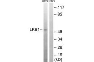 Western blot analysis of extracts from HT-29 cells, using LKB1 (Ab-334) Antibody. (LKB1 antibody  (AA 300-349))