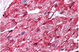 Immunohistochemistry (IHC) image for anti-Caveolin 1, Caveolae Protein, 22kDa (CAV1) (Internal Region) antibody (ABIN185421)